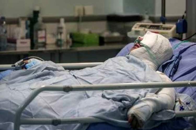 موفقیت پزشکان شیرازی در درمان یک مصدوم با سوختگی 75 درصد