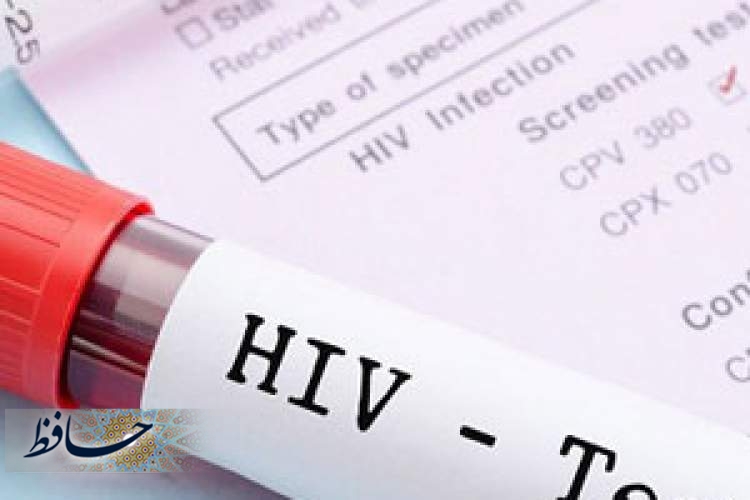 راه‌اندازی اتوبوس مشاوره و تست HIV در شیراز