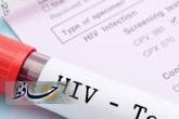 راه‌اندازی اتوبوس مشاوره و تست HIV در شیراز