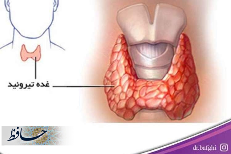 تیروئید چیست؟